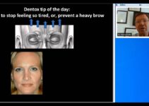 Botox Training | Prevent Heavy Brow & Fatigue Botox Training | Prevent Heavy Brow & Fatigue