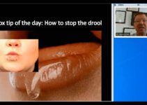 Botox Training | Concentrate to Treat Side Effects Botox Training | Concentrate to Treat Side Effects